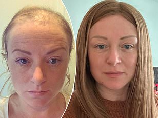 Groundbreaking Study Reveals Grey Hair May Be a Crucial Defense Against Cancer