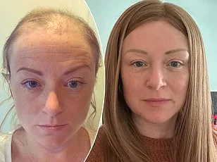 Groundbreaking Study Reveals Grey Hair May Be a Crucial Defense Against Cancer