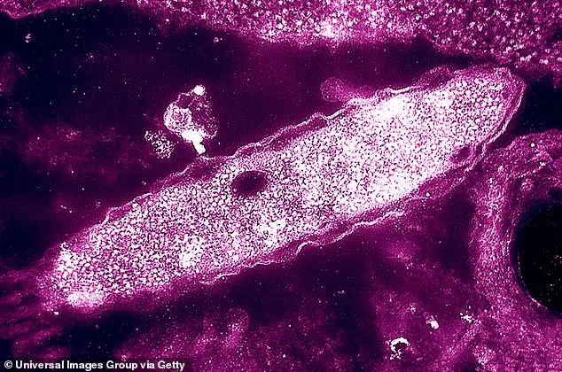 Legionnaires' Disease Outbreak in London Sparks UKHSA Probe into Waterborne Threat