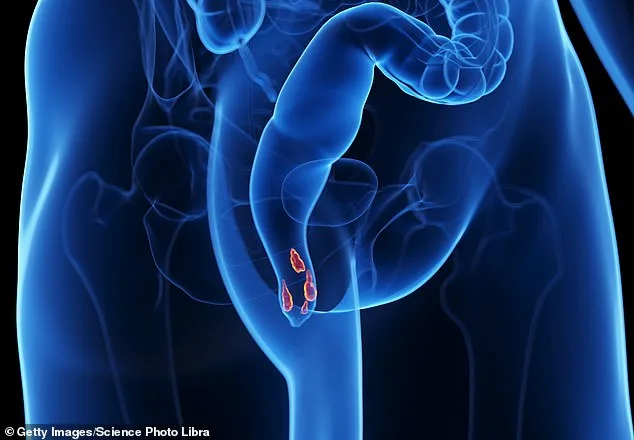 A Decade of Fear: How a Simple Habit Uncovered the Truth Behind Gagan's Hemorrhoid Struggle