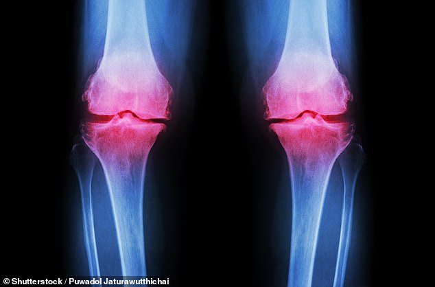 University of Nottingham Study Finds Low-Cost Inulin Supplement May Ease Osteoarthritis Pain