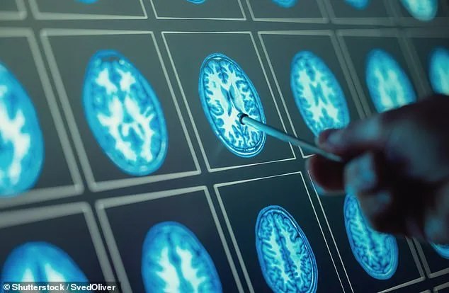 A Doctor's Early MS Diagnosis: How Awareness Made All the Difference