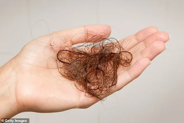 Baldness and Confidence: A Young Man's Battle with Hair Loss and the Tools He Used to Hide It