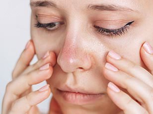 Mounjaro's Weight Loss Breakthrough Overshadowed by Nausea and Hair Loss