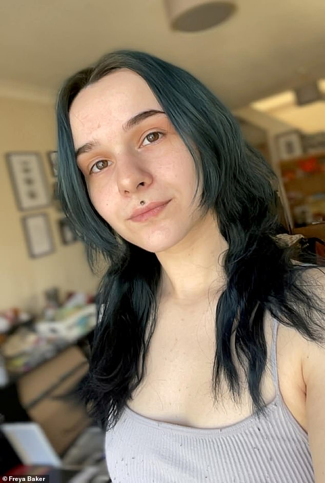 Unprecedented Crisis: 25-Year-Old Freya Baker Battles Hyperhidrosis, Facing Homelessness