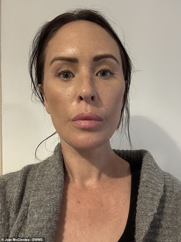 Over £10k Facelift in Turkey: Jojo McGinniss Faces Mixed Reactions After Transformative Surgery