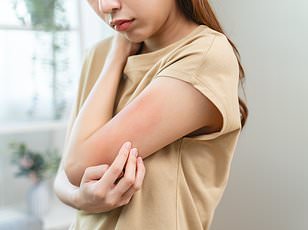 Urgent Warning: Expired Medications in Your Home Pose Health Risks – Experts Warn to Throw Them Out Now!