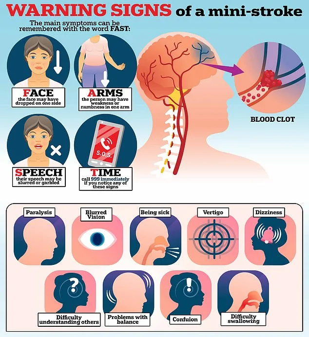 The Silent Warning: A Mini Stroke May Signal a Life-Threatening Emergency