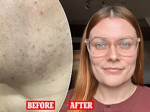 Inositol: A Simple Supplement That Transformed One Woman's Battle with PCOS