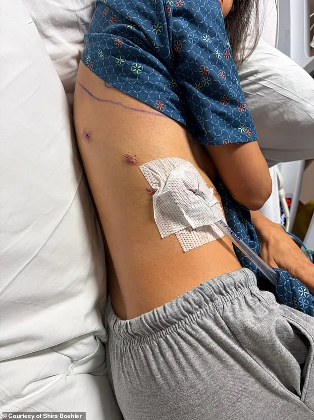 Rising Lung Cancer Rates in Non-Smokers Signal Growing Public Health Crisis