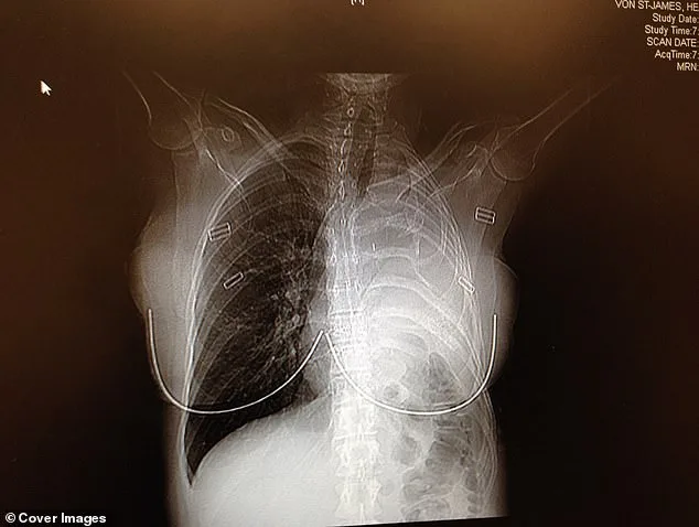 A Father's Jacket and the Illness That Changed Heather Von St James' Life