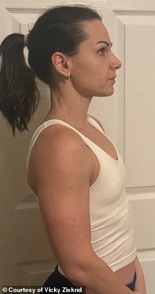 Innovative 'Cake Frosting Bag' Technique Redefines Breast Enlargement Surgery with Dr. Smita Ramanadham