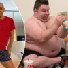 Content Creator Scott Perry's Extreme Weight Loss Journey Ends with Major Cosmetic Surgery