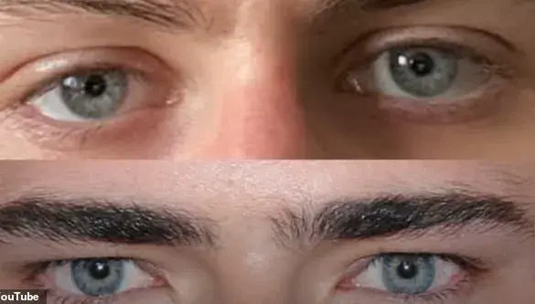 Exclusive: The Mysterious Steps Behind One Man's Yearlong Transformation from Ugly to Social Media Supermodel