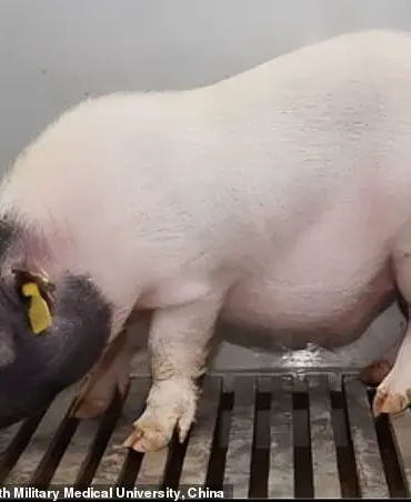 Historic First: Pig's Liver Successfully Transplanted into Human Patient