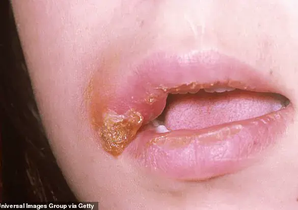 Janitor Sentenced for Spreading STDs at Houston Doctor's Office