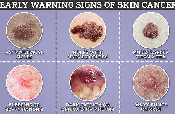 Katherine Ryan Battles Stage 4 Melanoma: Comedian Shares Struggle With Deadly Skin Cancer