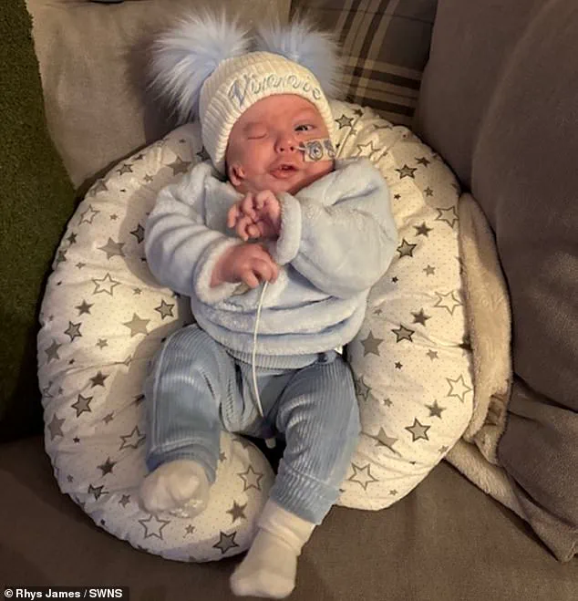 Rare syndrome leaves baby Vinnie James with misplaced ear and other developmental issues