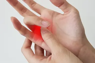 Understanding Trigger Finger: Causes, Symptoms, and Impact on Hand Mobility