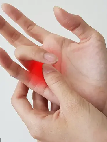 Understanding Trigger Finger: Causes, Symptoms, and Impact on Hand Mobility