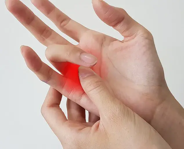 Understanding Trigger Finger: Causes, Symptoms, and Impact on Hand Mobility