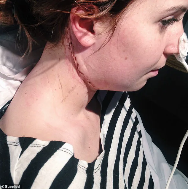 Bella's Christmas Battle: Family Confronts Eating Disorder Misunderstandings
