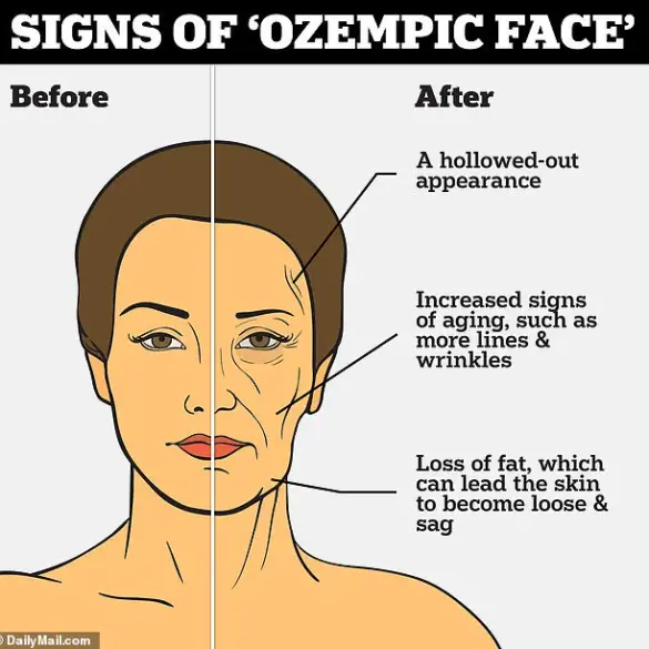 Expert Warns of Hidden Risks: Ozempic's Rapid Weight Loss Linked to Metabolic Stress and Physical Changes