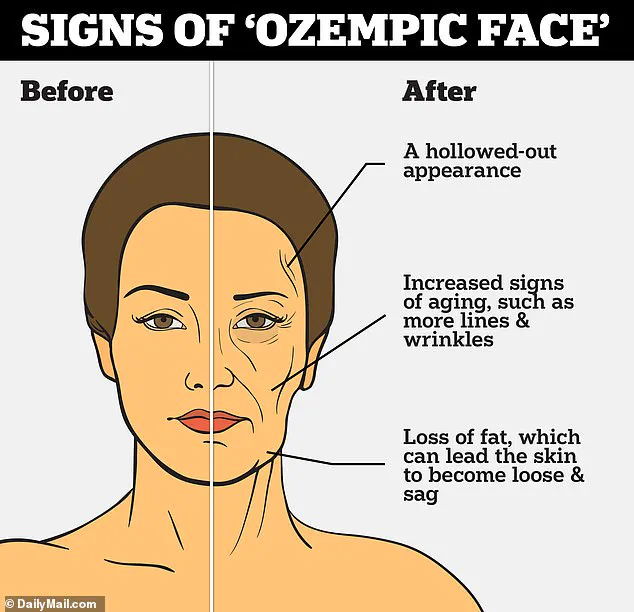 Expert Warns of Hidden Risks: Ozempic's Rapid Weight Loss Linked to Metabolic Stress and Physical Changes