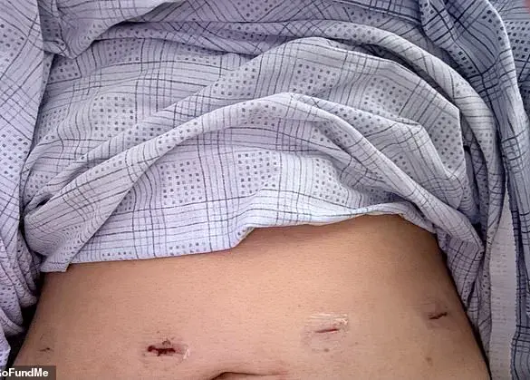 Over-The-Counter Vitamin Leads to Unexpected Health Crisis for Mother