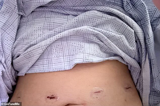 Over-The-Counter Vitamin Leads to Unexpected Health Crisis for Mother
