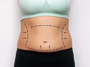 Social Media Backlash as Woman's Dramatic Weight Loss Reveals Regulation Gaps