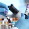 Statins May Reduce Risk of Death in Patients with Chronic Lymphocytic Leukemia