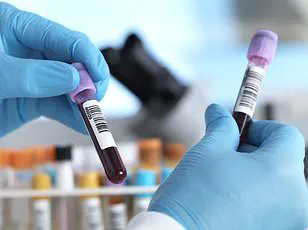 Statins May Reduce Risk of Death in Patients with Chronic Lymphocytic Leukemia