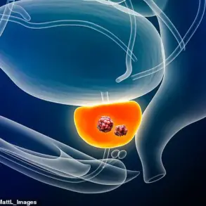 Breakthrough AI Test Cuts Prostate Cancer Death Risk by 50%, Say Researchers