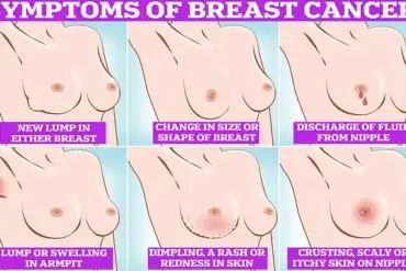 Exclusive Study Reveals Critical Links Between Reproductive Choices, Weight Gain, and Breast Cancer Risk, Prompting Urgent Public Health Advisories