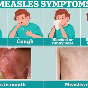 Texas Health Officials Warn Public After Measles Case at Major Baseball Event