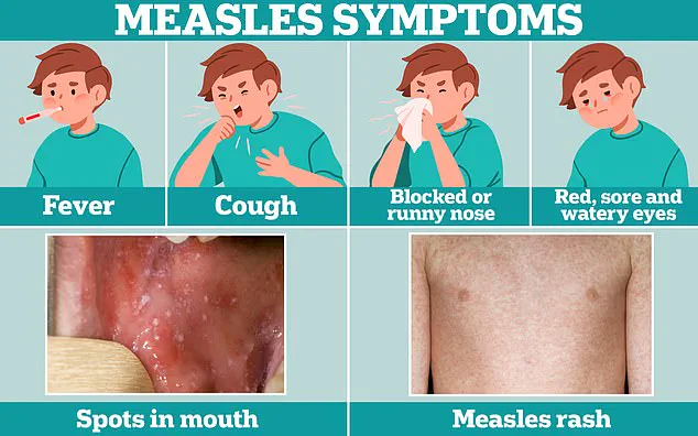 Texas Health Officials Warn Public After Measles Case at Major Baseball Event