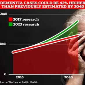 Varicose Veins Linked to 23.5% Higher Dementia Risk – Study Authors Warn of Hidden Health Crisis