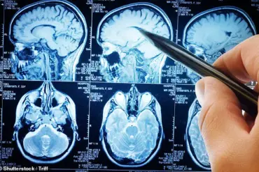California Study Suggests Low-Carb Diet May Slow Alzheimer's Progression by Targeting Brain Metabolism