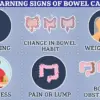 Landmark Study Reveals 1.5 Hours of Daily Exercise Can Cut Colon Cancer Death Risk by Over a Third, Presented at ASCO Conference