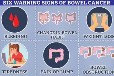 Landmark Study Reveals 1.5 Hours of Daily Exercise Can Cut Colon Cancer Death Risk by Over a Third, Presented at ASCO Conference
