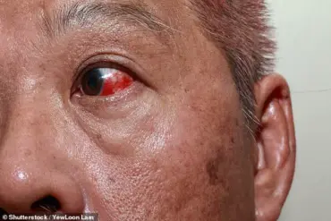 The Eyes as Early Warning Signs: How Ocular Changes Can Signal Serious Health Issues