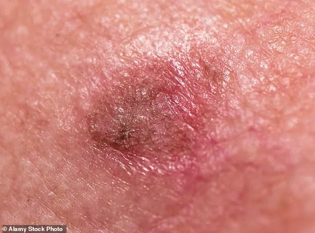 Understanding Skin Health: Distinguishing Normal Changes from Potential Concerns