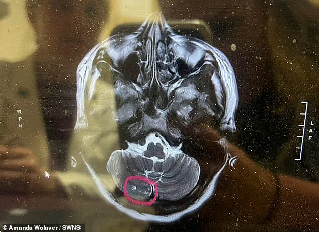 Amanda Wolaver's Mysterious Paralysis After Botox: 'I Thought I Was Slowly Dying' and a £22,000 Quest for Answers