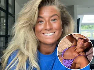 Exclusive Insights: Megan Blain's Reluctant Revelation on Sunbed Dangers
