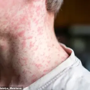 Expert Warnings as Measles Resurgence Looms Amid Sharp Drop in MMR Vaccination Rates