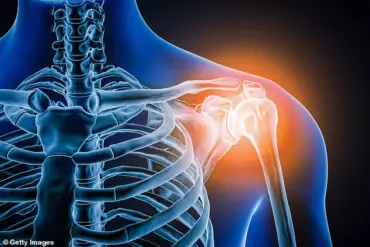 Late-Breaking: Emma Mapp's Shoulder Pain Escalates to Debilitating Condition