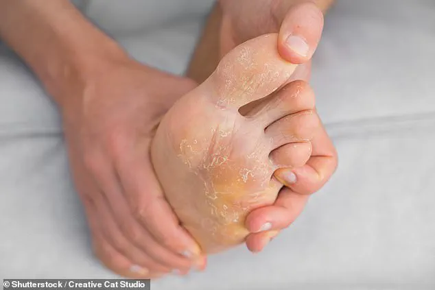Leading Podiatrist Issues Critical Warnings on Common Foot Care Mistakes That Could Lead to Long-Term Pain and Injury