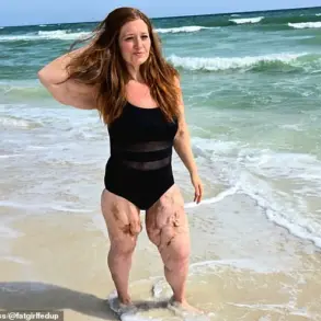 Lexi Reed’s Inspiring Journey from 22 Stone Weight Loss to Becoming a Body-Positivity Advocate