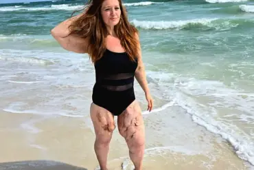 Lexi Reed’s Inspiring Journey from 22 Stone Weight Loss to Becoming a Body-Positivity Advocate